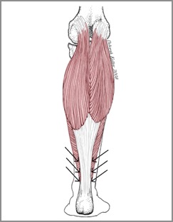 Achilles tendon
